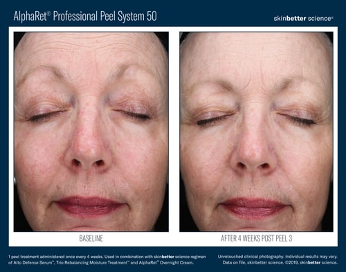 B&A+Prof+Peel+1