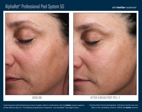 B&A+Prof+Peel+2