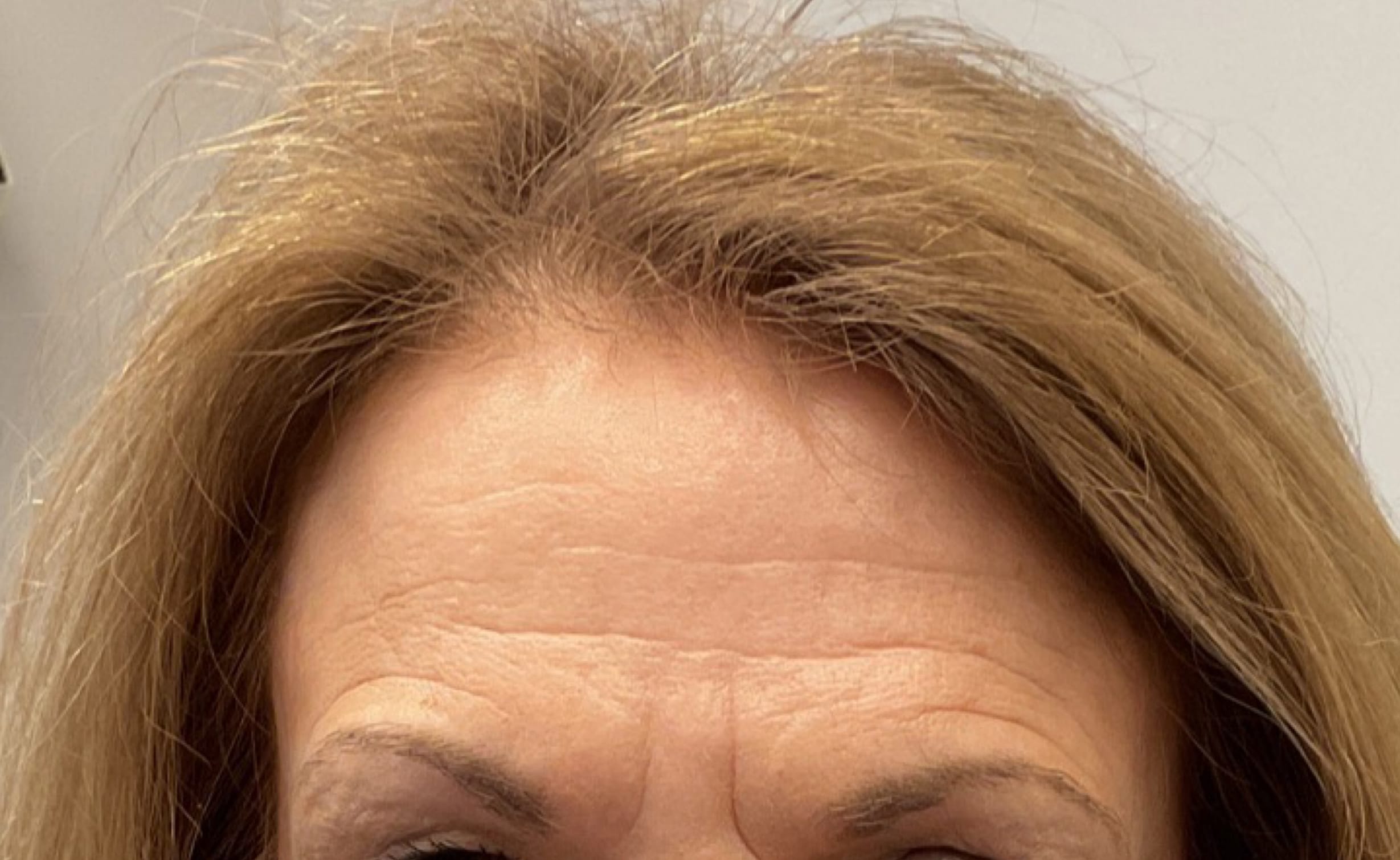 After Image: Neurotoxins - front