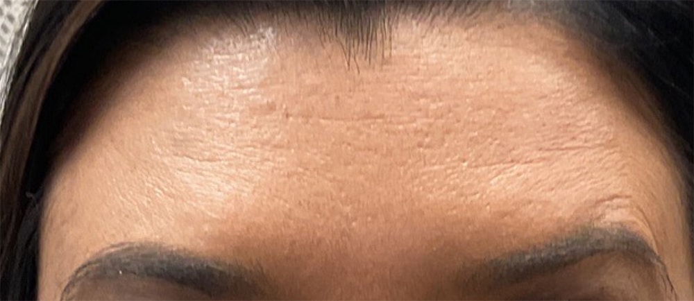 After Image: Neurotoxins - front