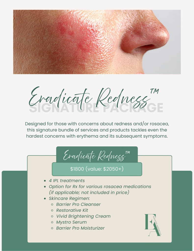 Elevated Aesthetics Signature Packages