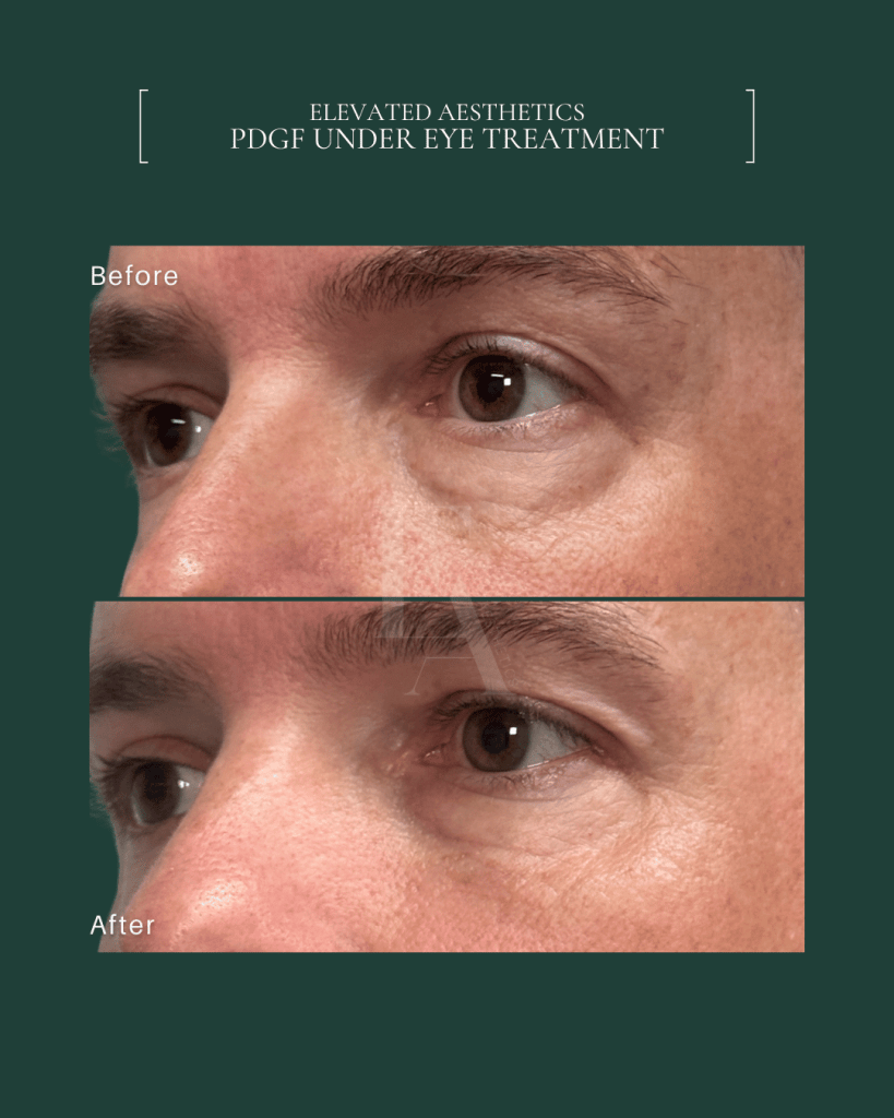 Elevated Aesthetics PDGF Under Eye Treatment